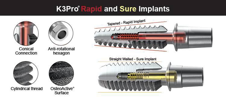 izmirde uygun fiyatlı implant 